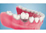 create realistic 3d dental implant and dental procedure animations
